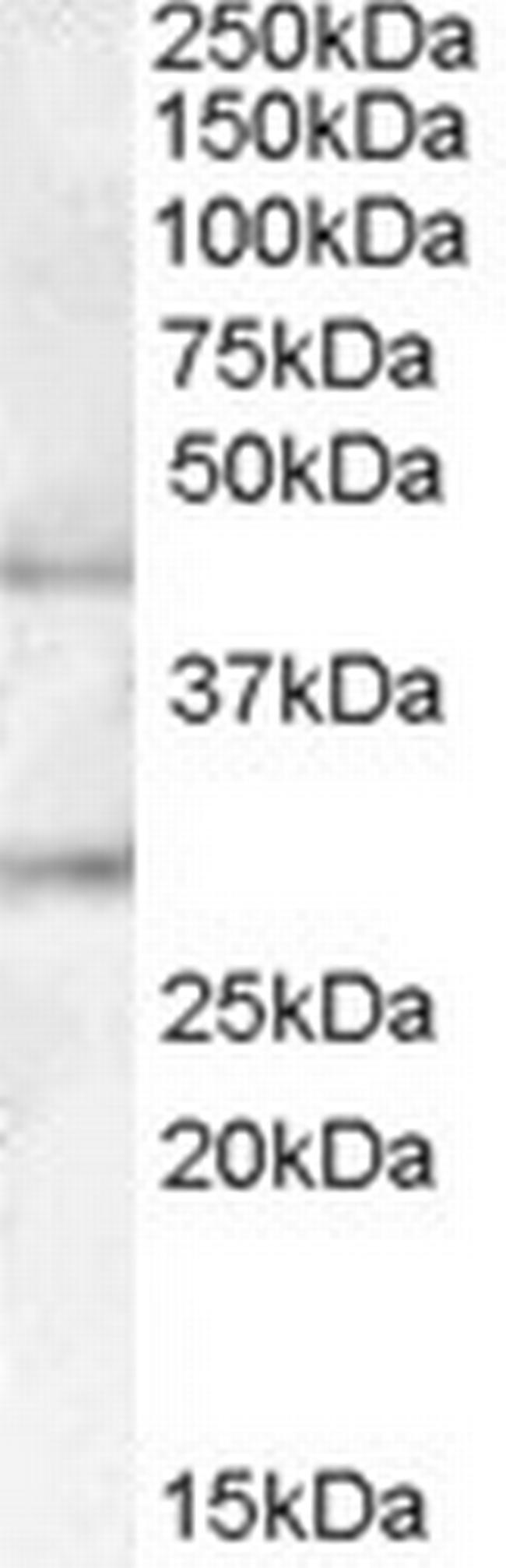 B3GNT2 Antibody in Western Blot (WB)