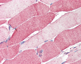 Arylsulfatase B Antibody in Immunohistochemistry (Paraffin) (IHC (P))