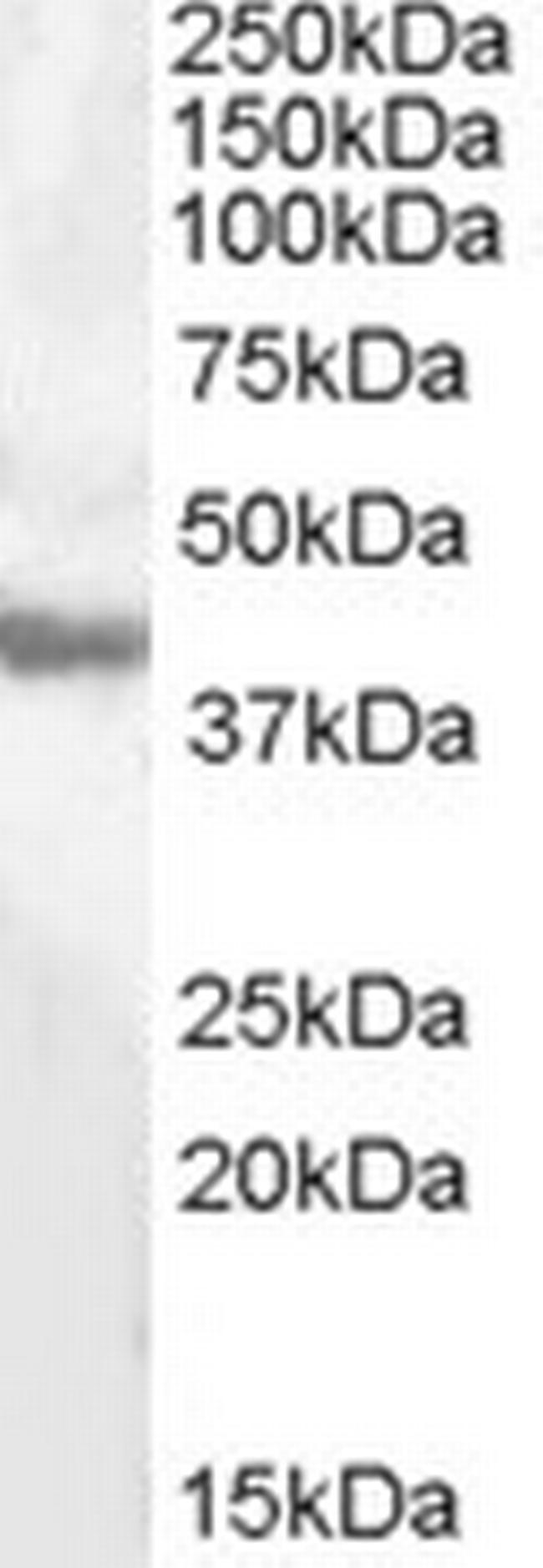 GOT1 Antibody in Western Blot (WB)