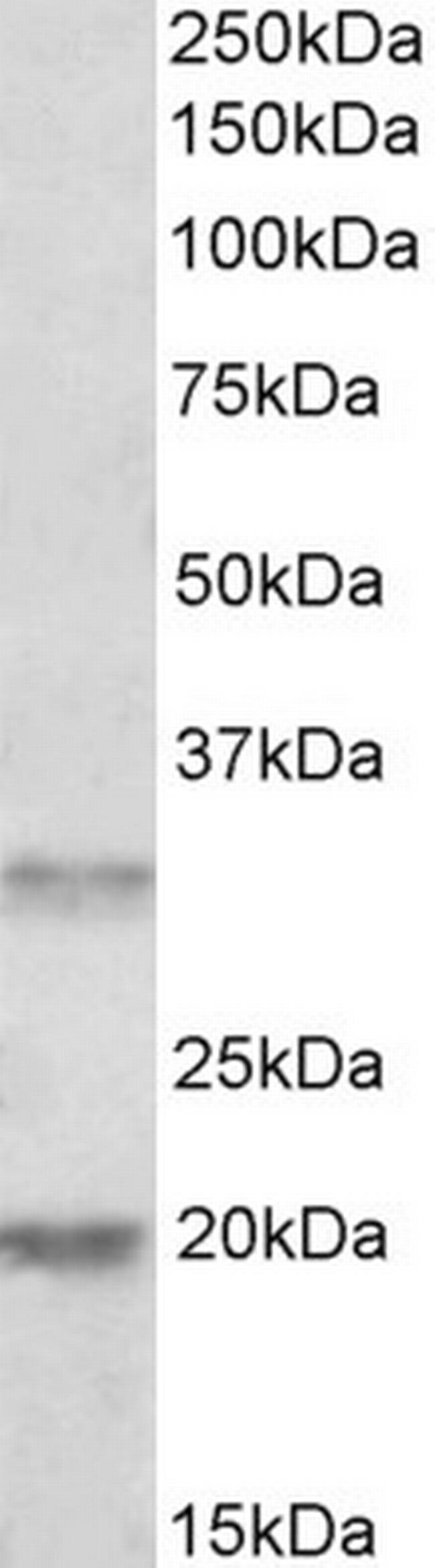 ALP Antibody in Western Blot (WB)