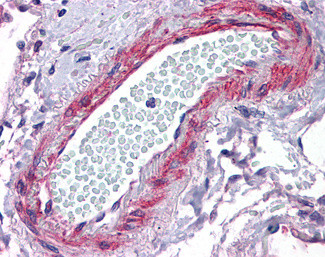 CRP2 Antibody in Immunohistochemistry (Paraffin) (IHC (P))