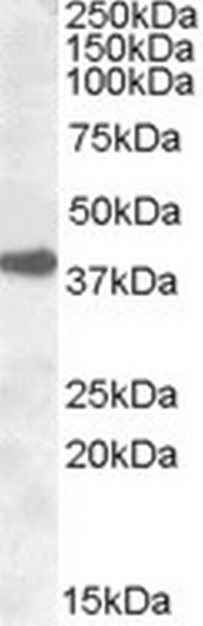 ERCC1 Antibody in Western Blot (WB)