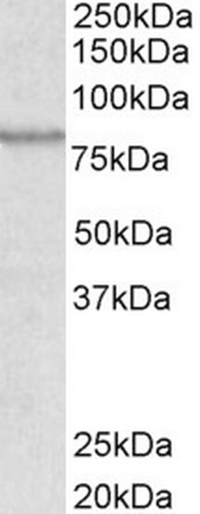 ABCB5 Antibody in Western Blot (WB)