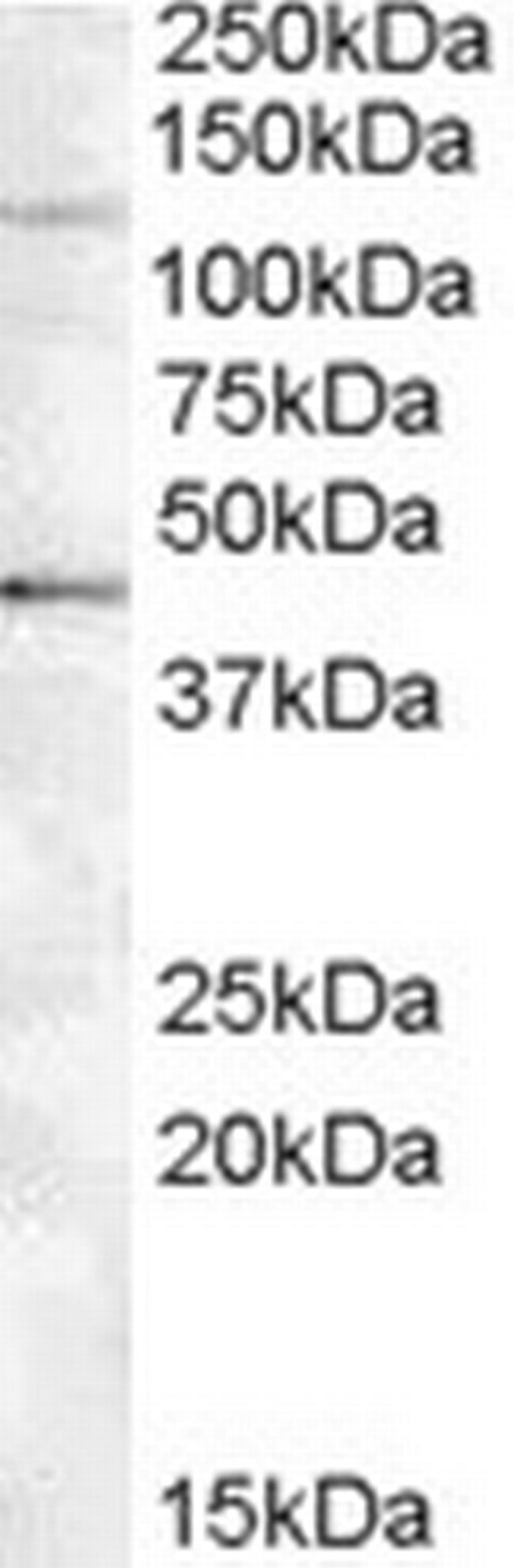 Tankyrase 2 Antibody in Western Blot (WB)