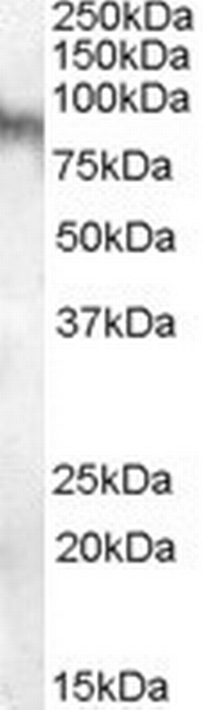 NLGN3 Antibody in Western Blot (WB)