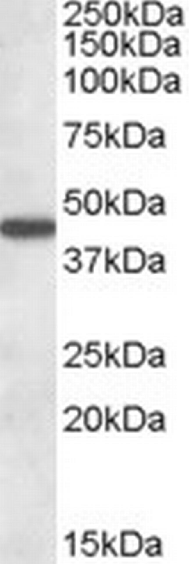 AADAT Antibody in Western Blot (WB)