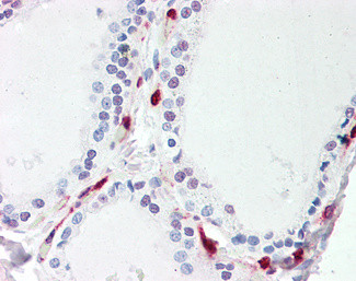 ATP13A1 Antibody in Immunohistochemistry (Paraffin) (IHC (P))