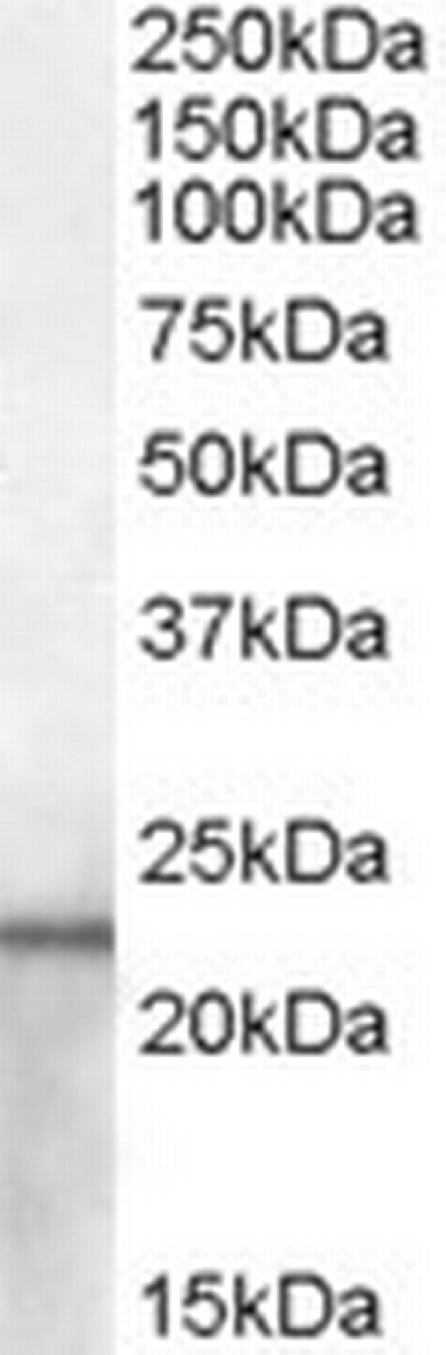 NGAL Antibody in Western Blot (WB)