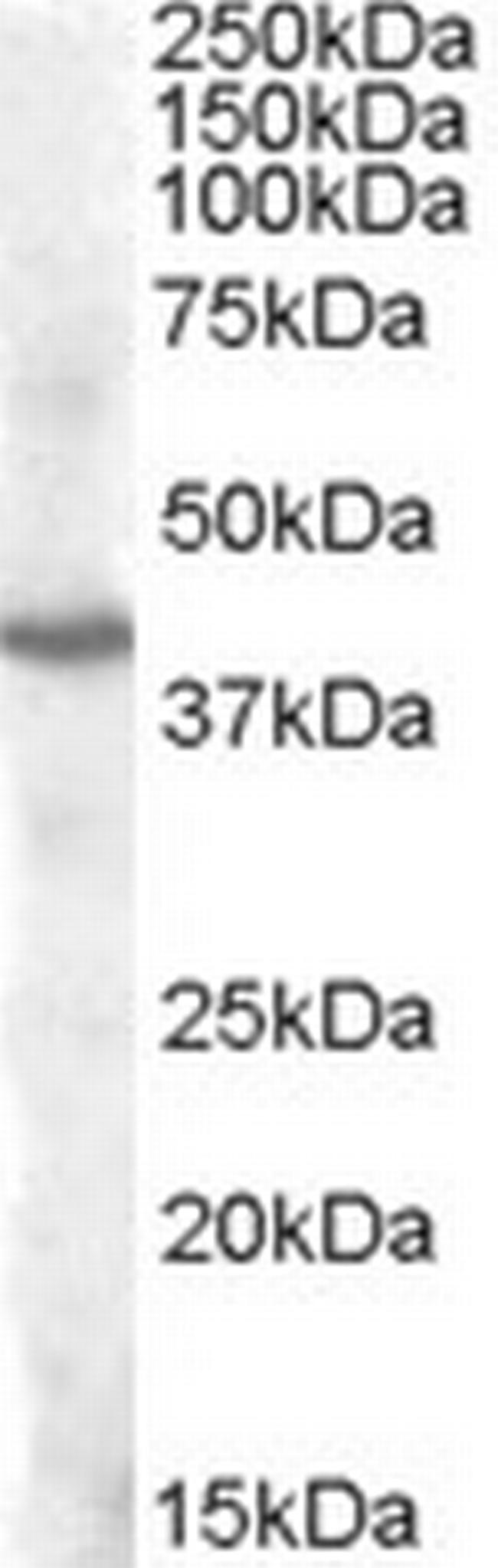 PITX3 Antibody in Western Blot (WB)