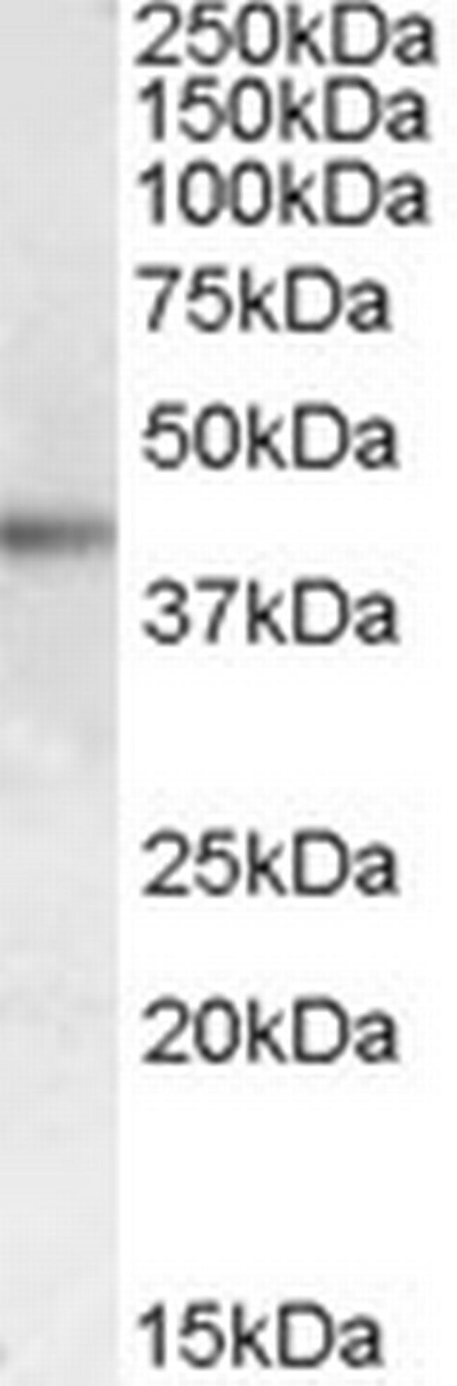 MC2R Antibody in Western Blot (WB)