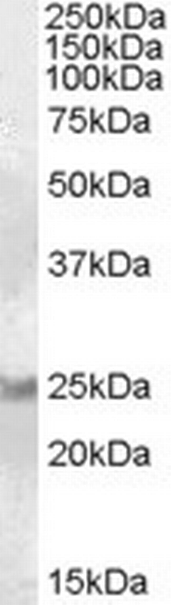 RAB8A Antibody in Western Blot (WB)