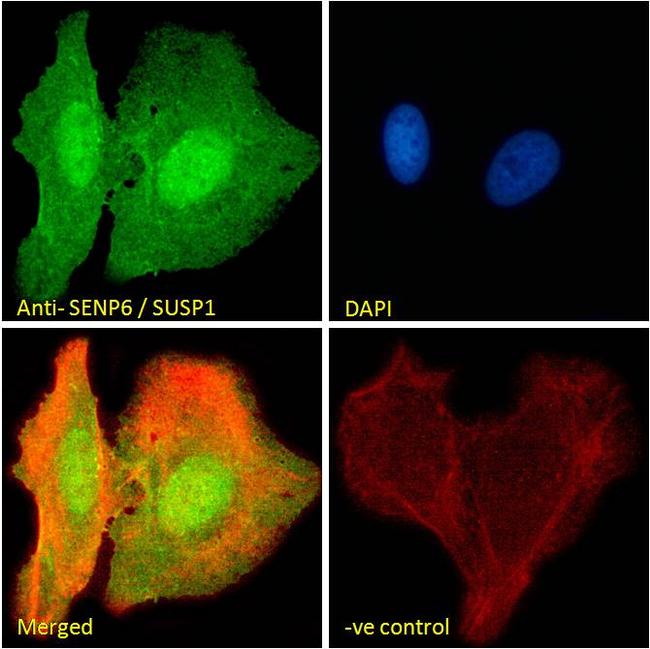 SENP6 Antibody in Immunocytochemistry (ICC/IF)