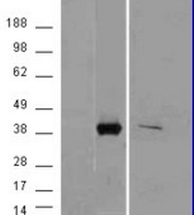 AKR1B10 Antibody in Western Blot (WB)