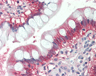 N-Ras Antibody in Immunohistochemistry (Paraffin) (IHC (P))