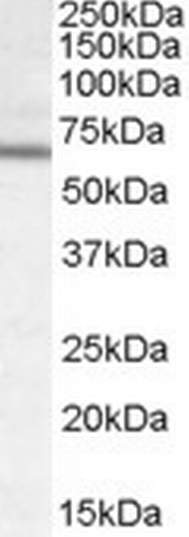 DACH2 Antibody in Western Blot (WB)