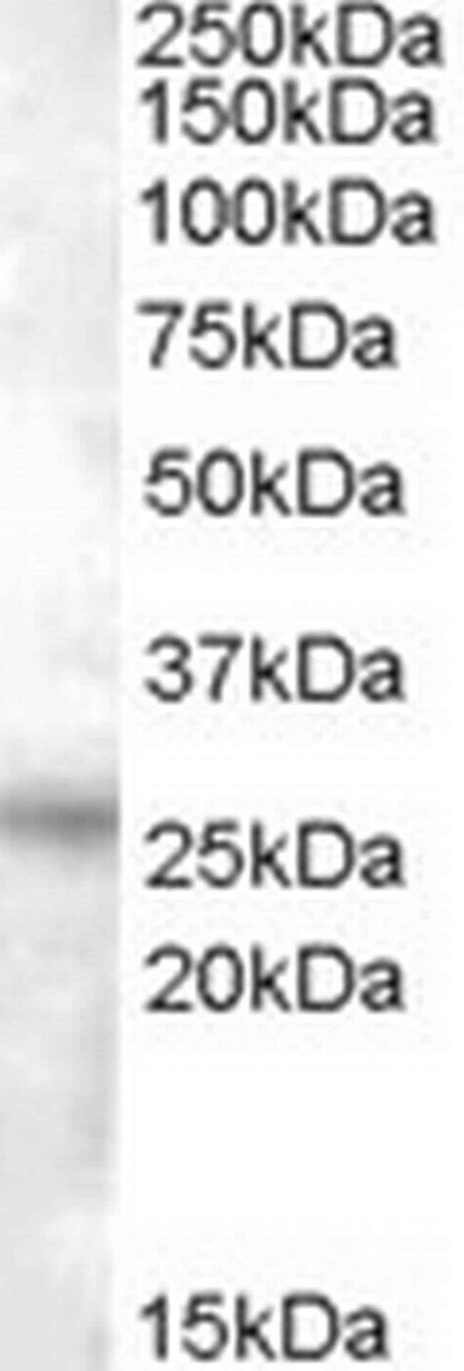 RASSF3 Antibody in Western Blot (WB)