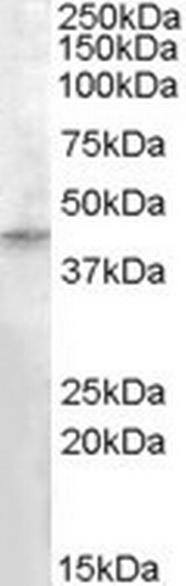 RASSF8 Antibody in Western Blot (WB)