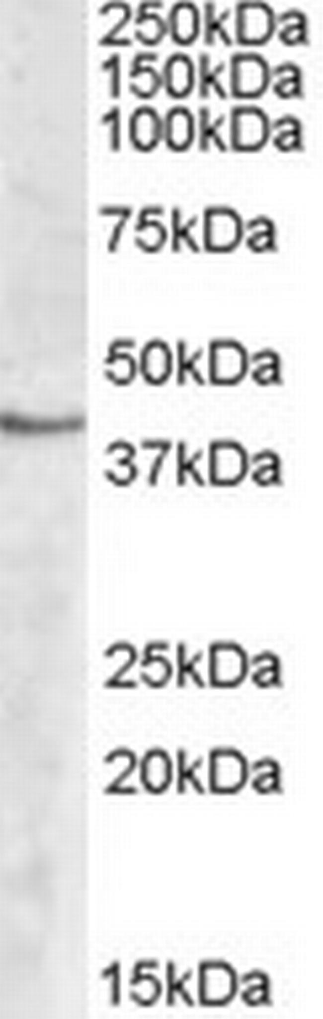 SPHK1 Antibody in Western Blot (WB)