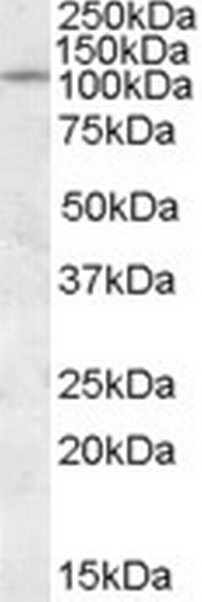 PTPRN Antibody in Western Blot (WB)