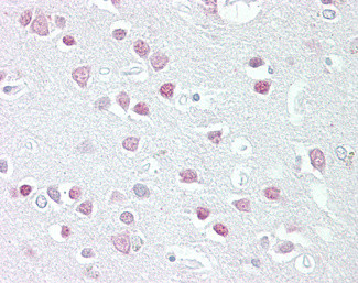 MC5R Antibody in Immunohistochemistry (Paraffin) (IHC (P))