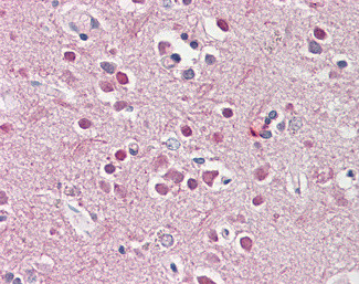 CHRNB2 Antibody in Immunohistochemistry (Paraffin) (IHC (P))