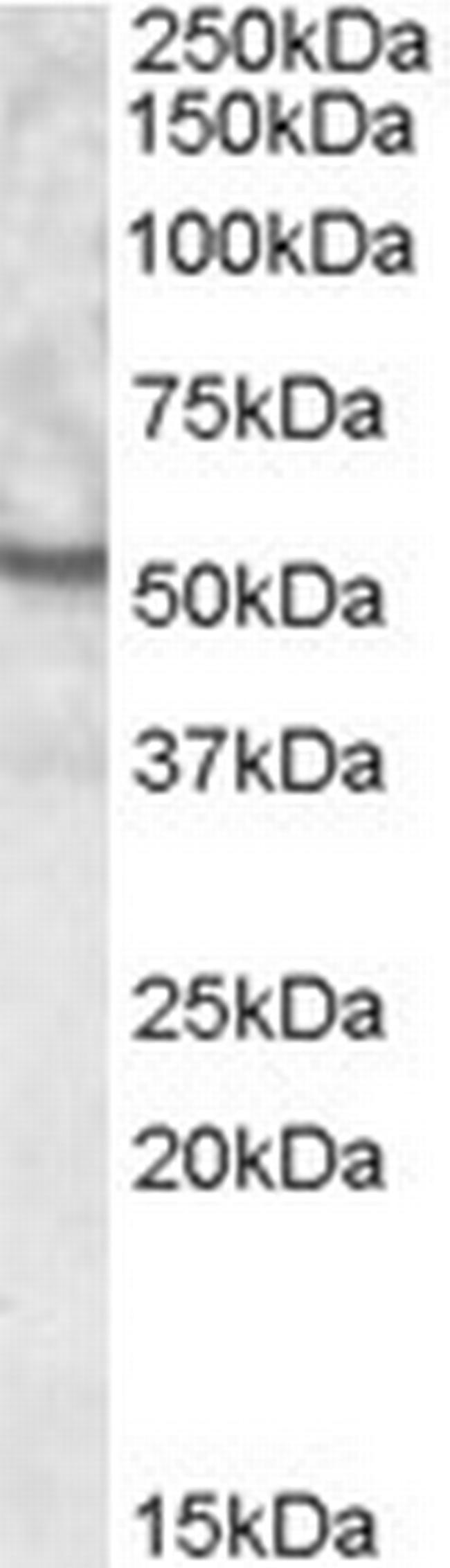 UNC5CL Antibody in Western Blot (WB)