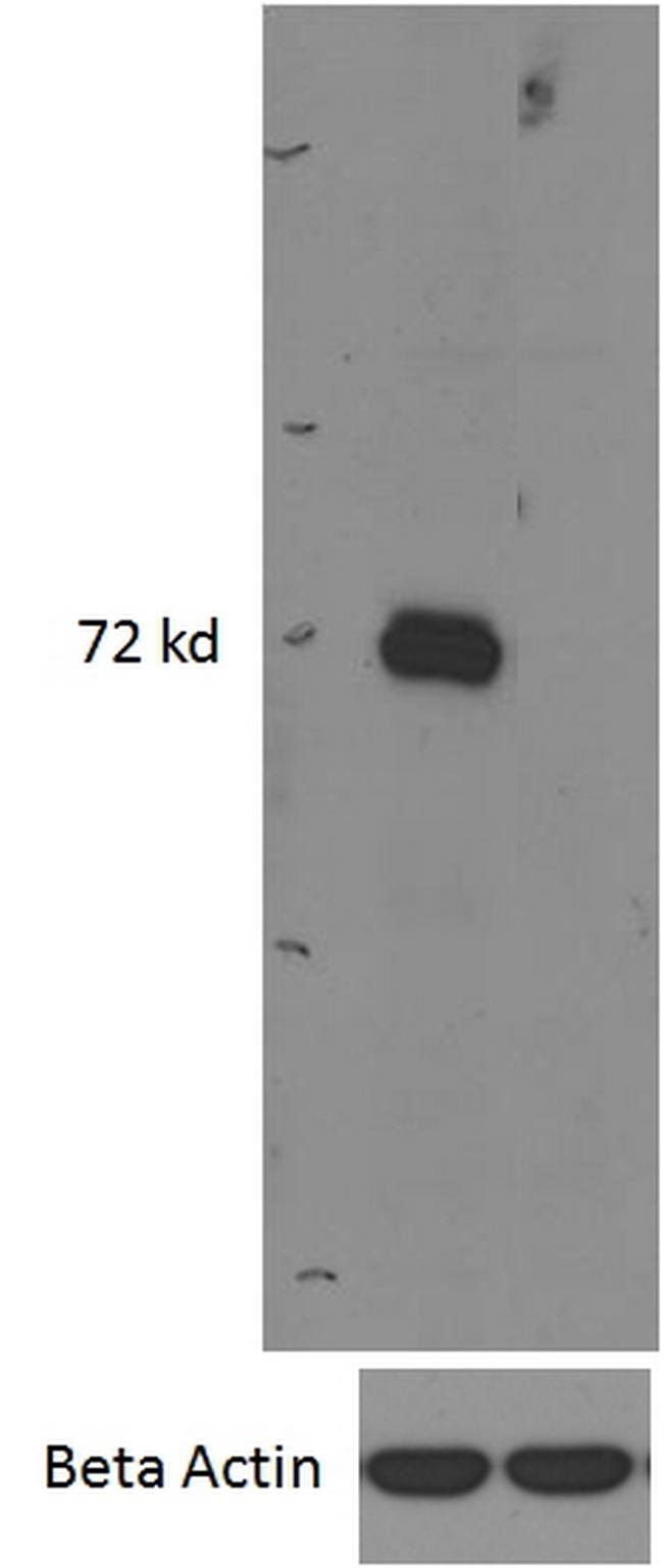 IRAK-M Antibody in Western Blot (WB)