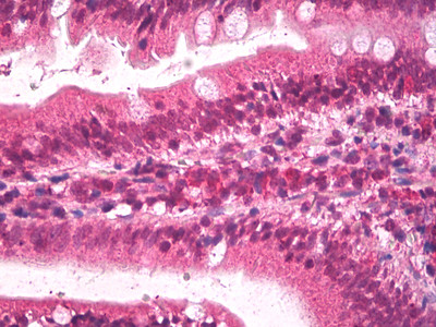 Apolipoprotein B Antibody in Immunohistochemistry (Paraffin) (IHC (P))