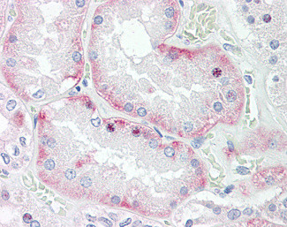 HOXD10 Antibody in Immunohistochemistry (Paraffin) (IHC (P))