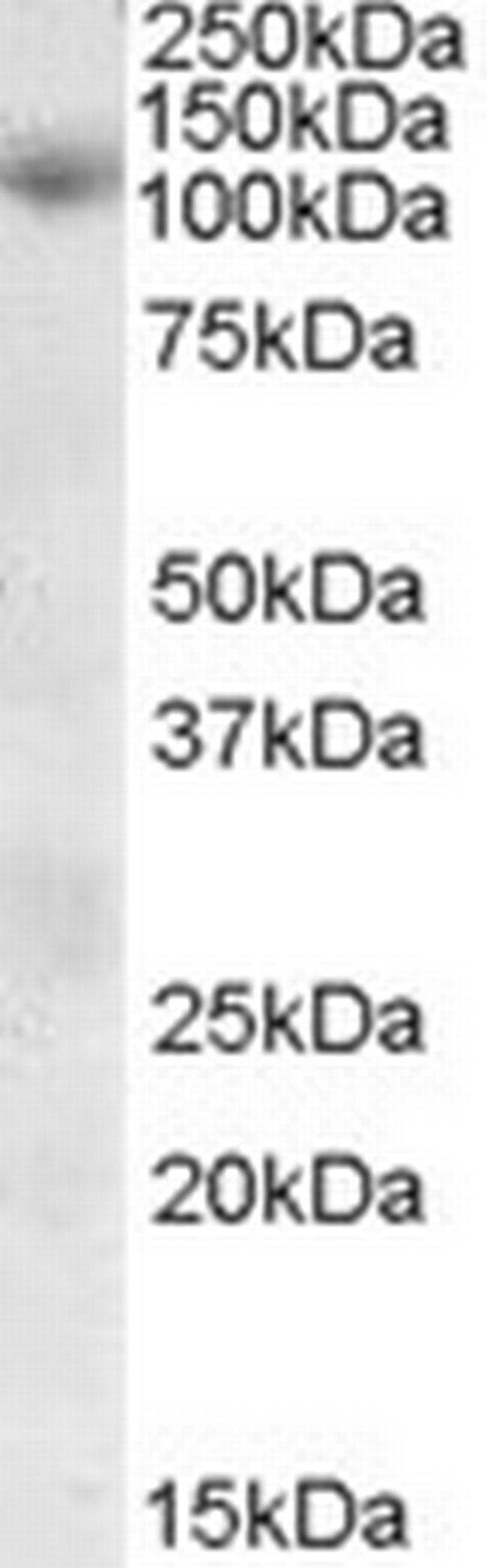 SNX19 Antibody in Western Blot (WB)