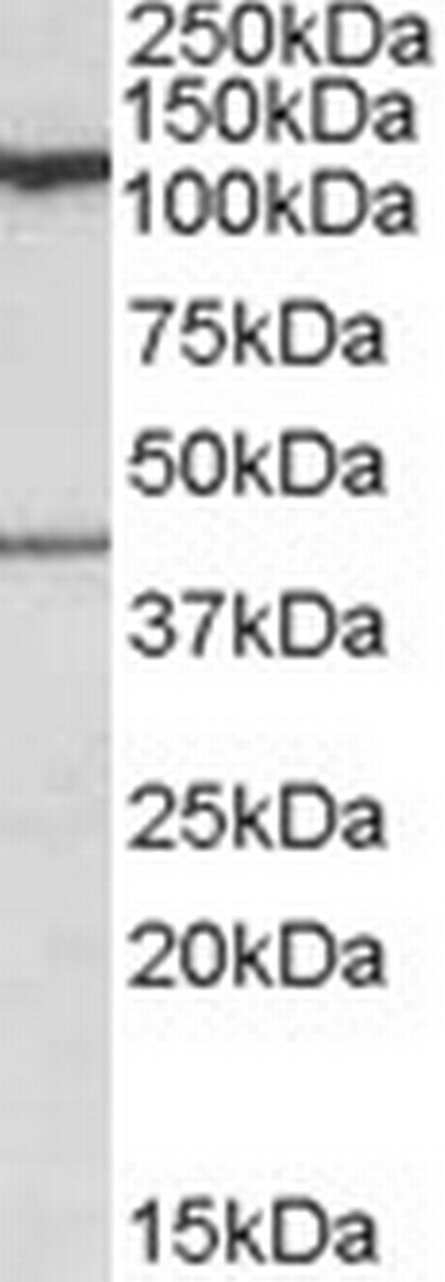 COG1 Antibody in Western Blot (WB)