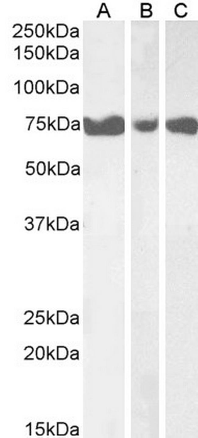 ITPKC Antibody in Western Blot (WB)