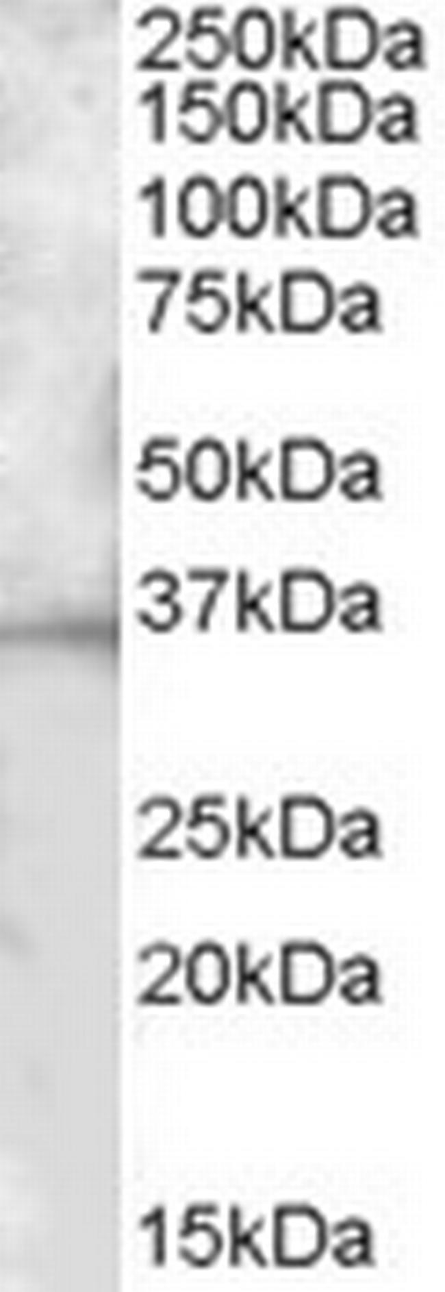 BTLA Antibody in Western Blot (WB)