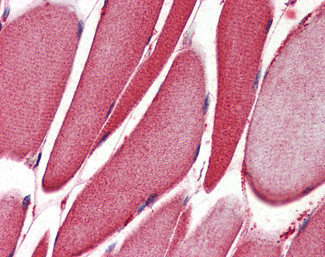 ALOX15 Antibody in Immunohistochemistry (Paraffin) (IHC (P))