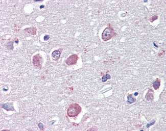 GABRB3 Antibody in Immunohistochemistry (Paraffin) (IHC (P))