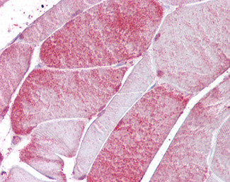 CSRP3 Antibody in Immunohistochemistry (Paraffin) (IHC (P))