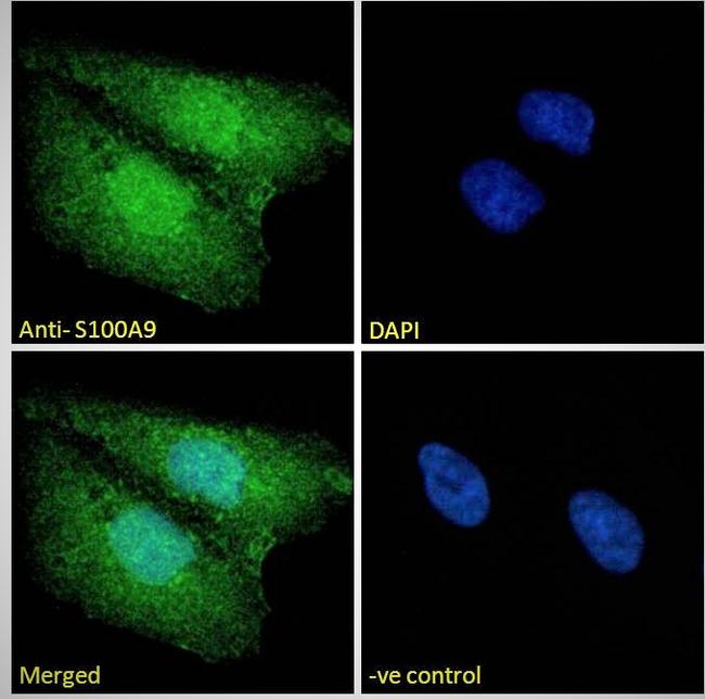 S100A9 Antibody in Immunocytochemistry (ICC/IF)