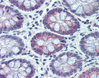 PXR Antibody in Immunohistochemistry (Paraffin) (IHC (P))