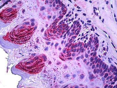 TSPO Antibody in Immunohistochemistry (Paraffin) (IHC (P))