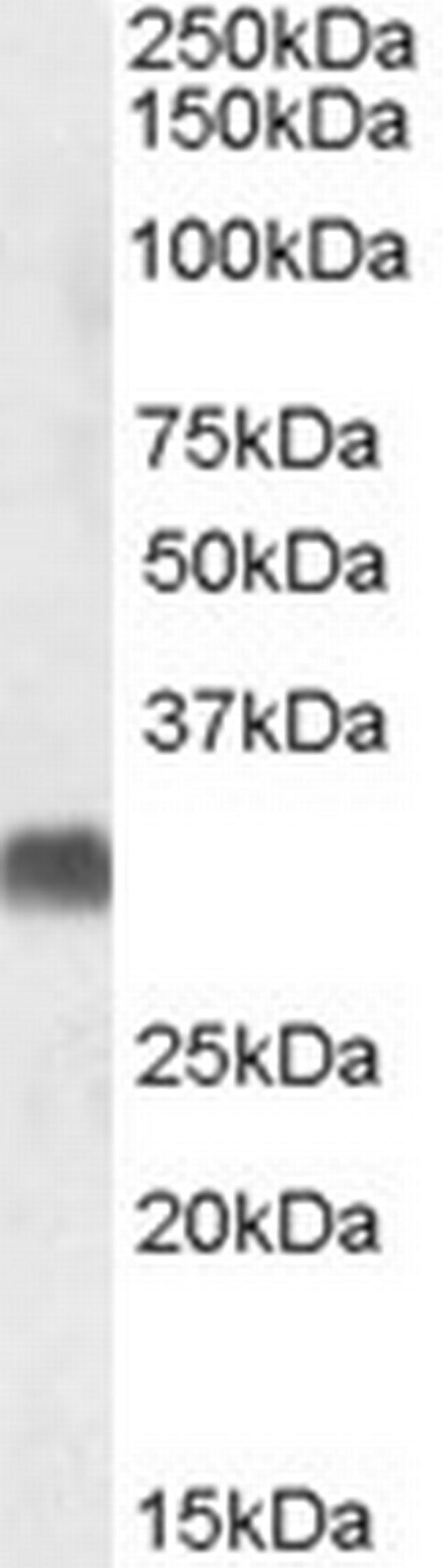 SRD5A2 Antibody in Western Blot (WB)