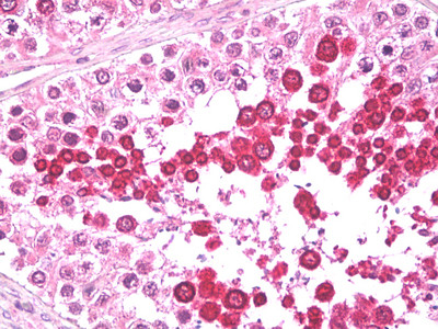 HIPPI Antibody in Immunohistochemistry (Paraffin) (IHC (P))