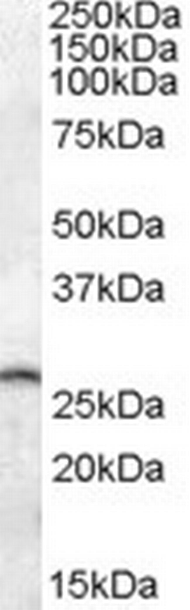 PSPH Antibody in Western Blot (WB)