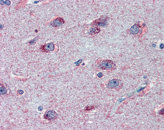 FMRP Antibody in Immunohistochemistry (Paraffin) (IHC (P))