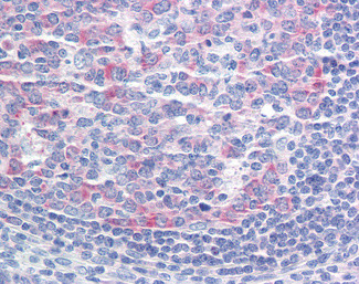 TCP-1 gamma Antibody in Immunohistochemistry (Paraffin) (IHC (P))