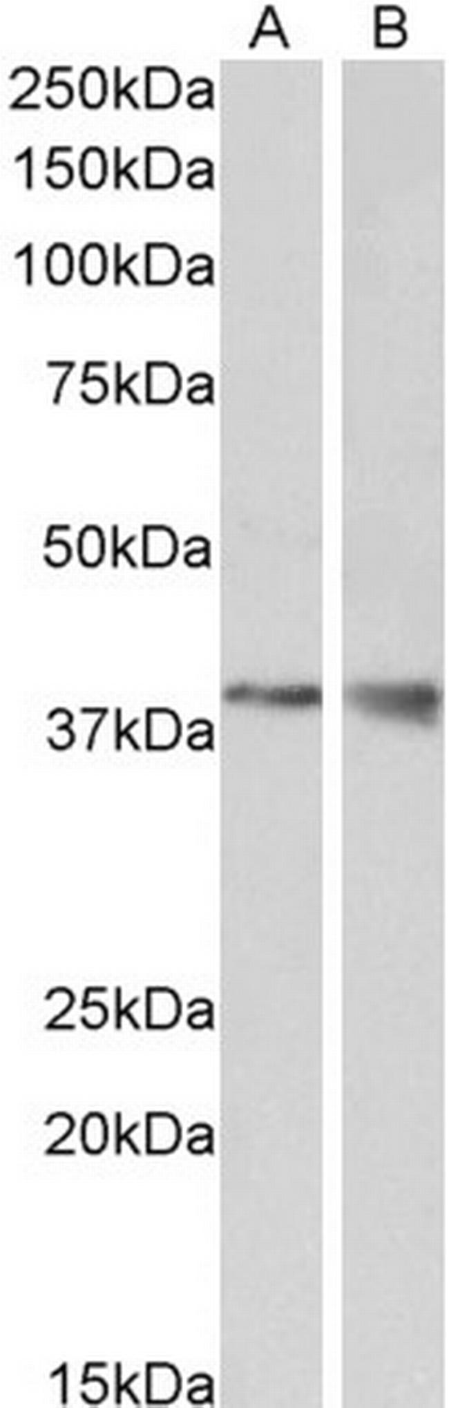 WNT9B Antibody in Western Blot (WB)