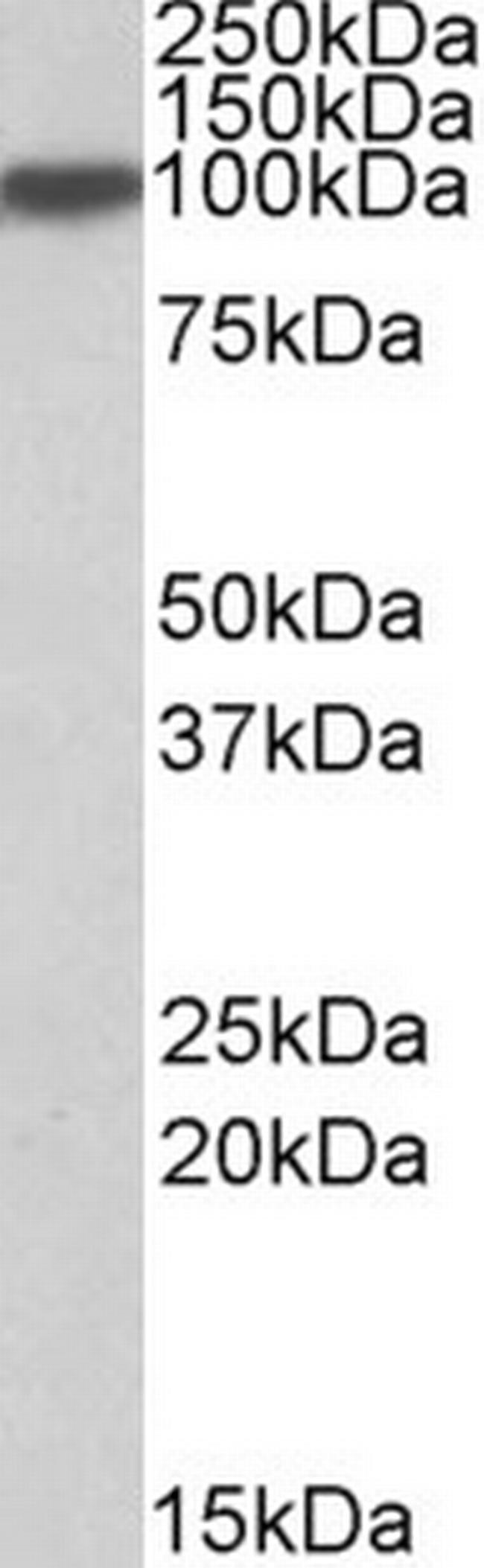 Aconitase 1 Antibody in Western Blot (WB)