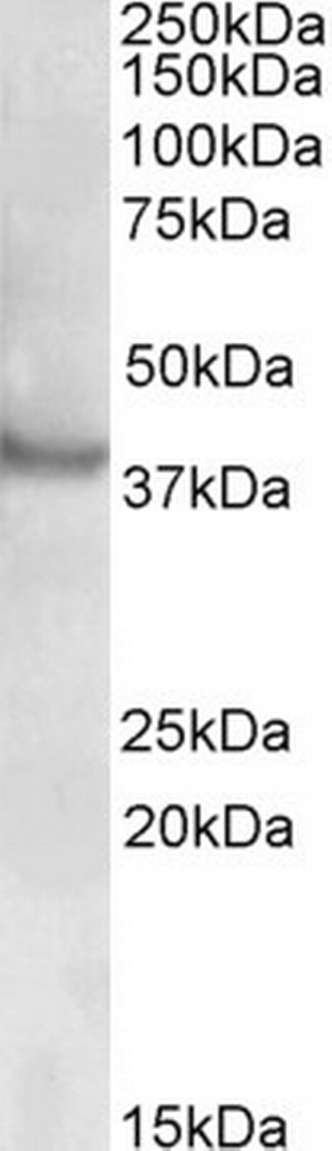 RAPSN Antibody in Western Blot (WB)