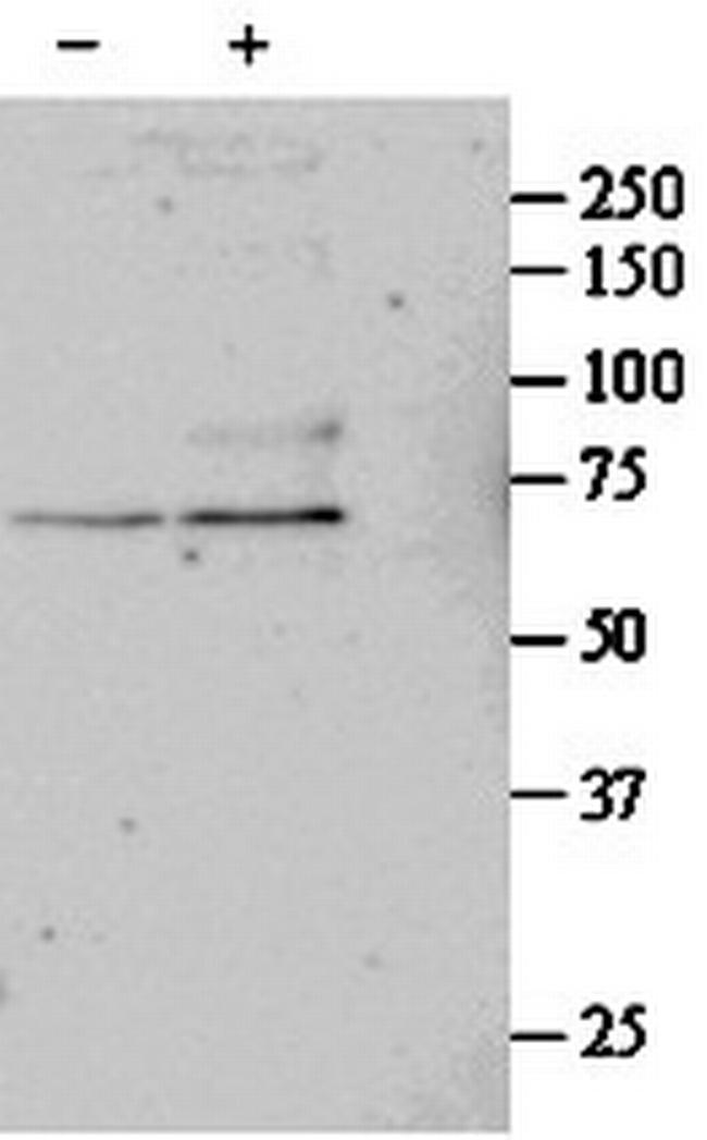 SRF Antibody in Western Blot (WB)