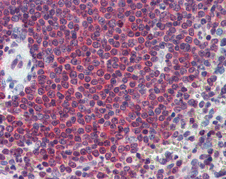 Carbonic Anhydrase I Antibody in Immunohistochemistry (Paraffin) (IHC (P))