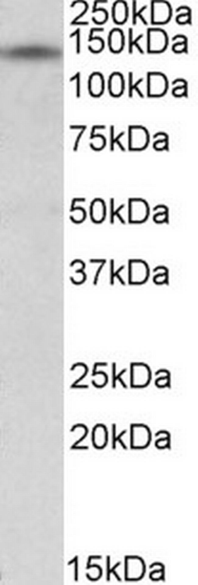 RIP140 Antibody in Western Blot (WB)